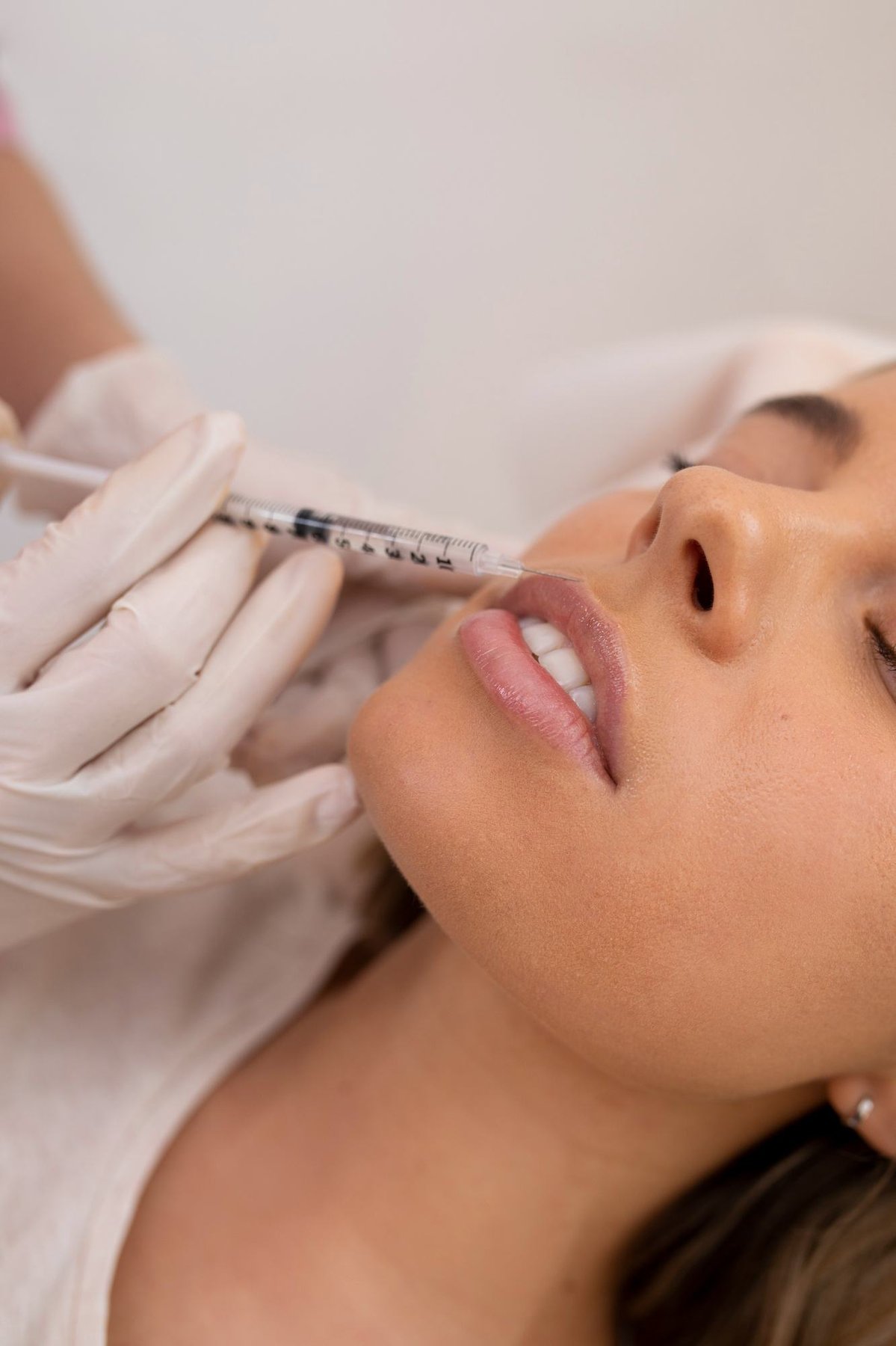 Preenchimento Labial