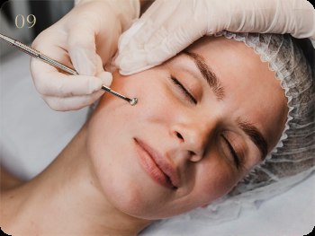 Peeling de Melan